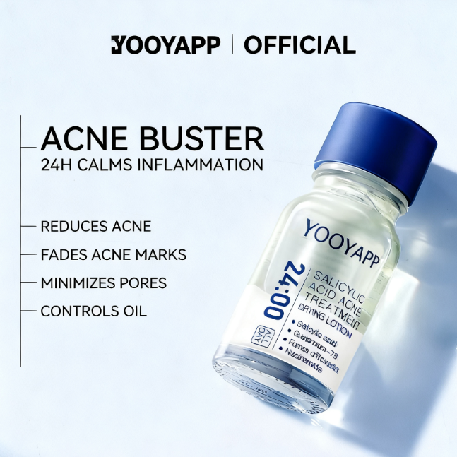 Acne Treatment Drying Lotion | Inflammation Relief, Post-Blemish Care & Oil Control