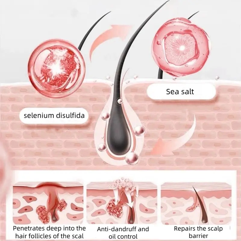 Anti-Dandruff Selenium Disulfide Scalp Shampoo