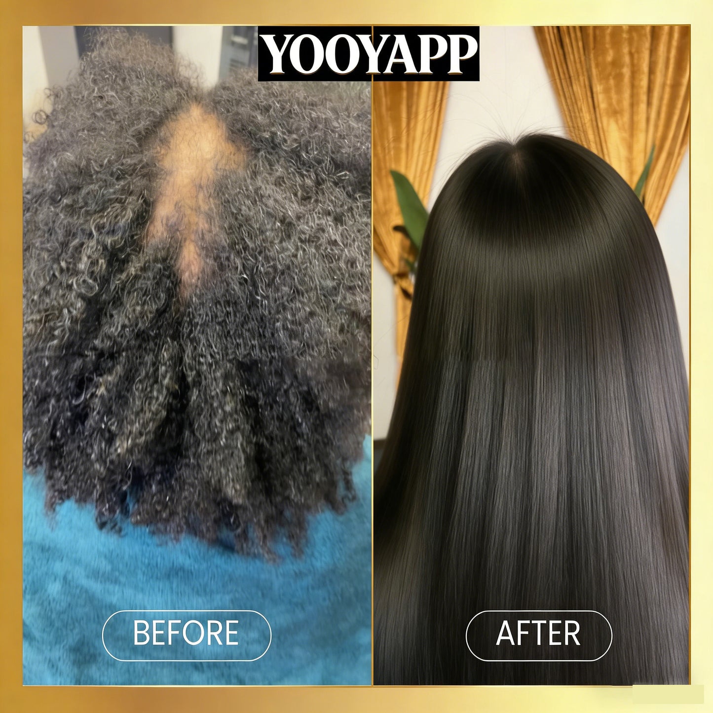 Scalp Stimulator Hair Growth Oil