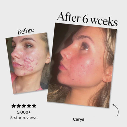 Anti-Blemish & Scar Repair Serum