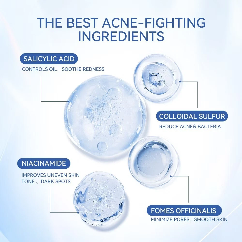 Acne Treatment Drying Lotion | Inflammation Relief, Post-Blemish Care & Oil Control