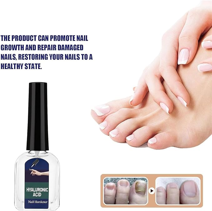 Antifungal Nail Repair Solution