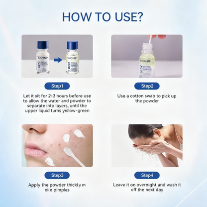 Acne Treatment Drying Lotion | Inflammation Relief, Post-Blemish Care & Oil Control