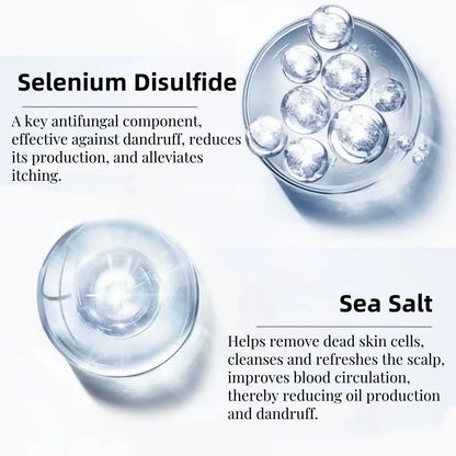 Anti-Dandruff Selenium Disulfide Scalp Shampoo