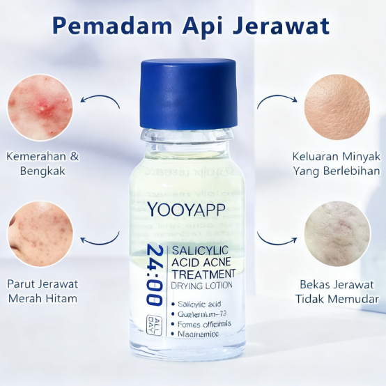 Acne Treatment Drying Lotion | Inflammation Relief, Post-Blemish Care & Oil Control