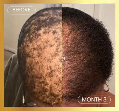 Scalp Stimulator Hair Growth Oil