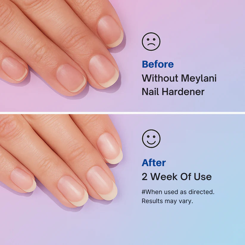 NAIL REVIVAL