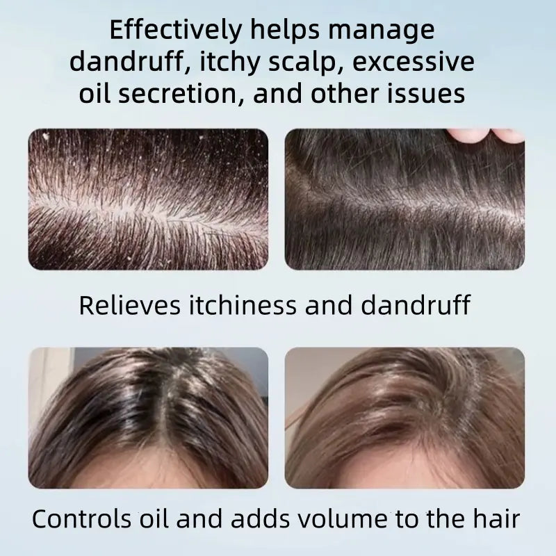 Anti-Dandruff Selenium Disulfide Scalp Shampoo