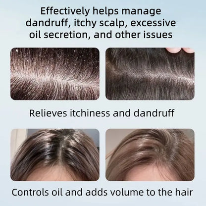 Anti-Dandruff Selenium Disulfide Scalp Shampoo