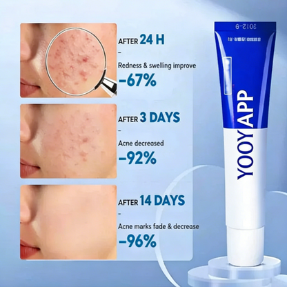 Portable Skin Soothing Balm