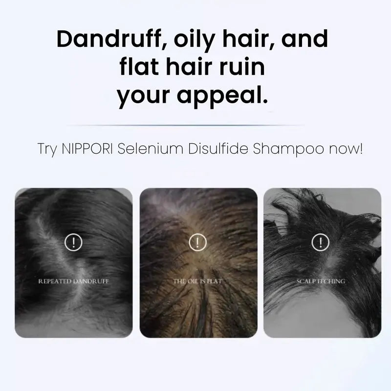Anti-Dandruff Selenium Disulfide Scalp Shampoo