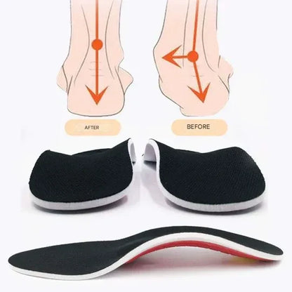 ArchEase™ - Orthopedic Insoles with Arch Support